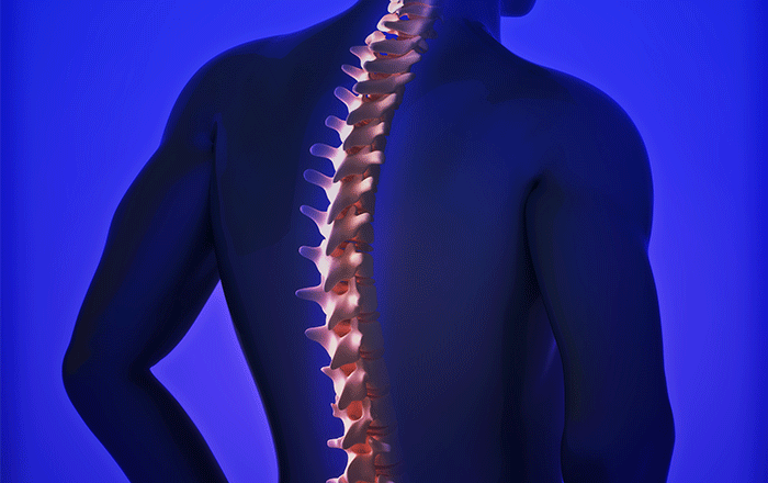 Lumbar Discectomy