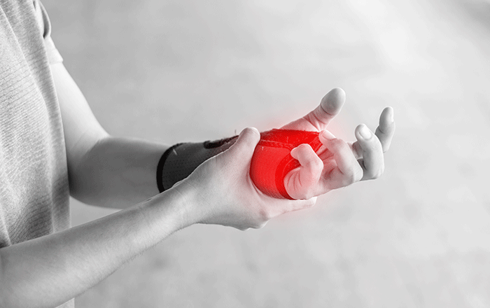 Carpal tunnel anatomy diagram